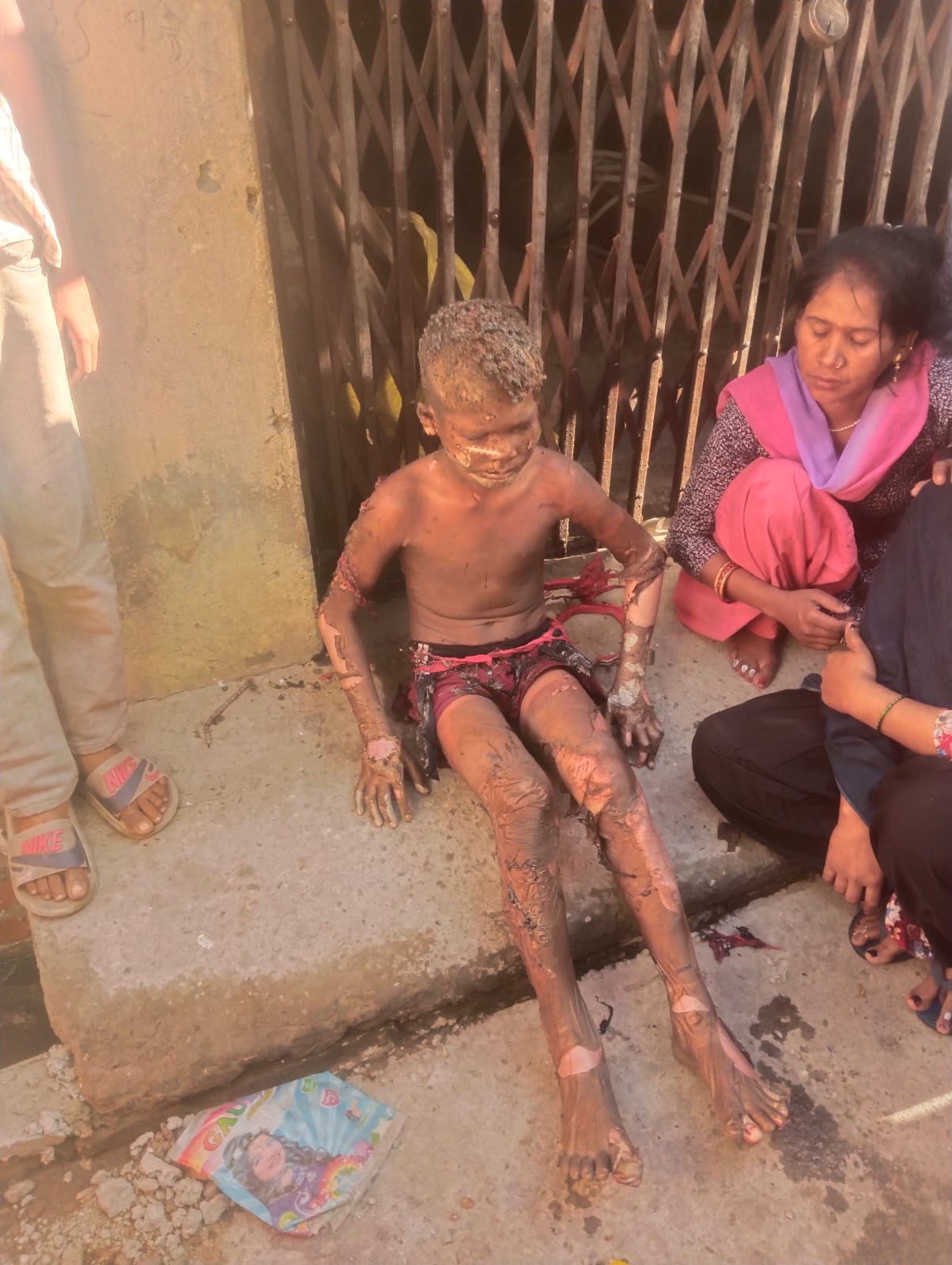 रुद्रपुर में सिलेंडर फटने से लगी आग, मां-बेटे सहित चार गंभीर रूप से झुलसे